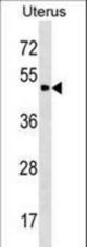 PLA2G3 Antibody western blot of Uterus tissue lysates (35 ug/lane). The PLA2G3 antibody detected the PLA2G3 protein (arrow).