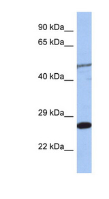 MIS12 antibody LS-C112174 Western blot of Jurkat lysate.