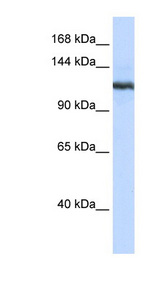 PLA2G4B / CPLA2-Beta antibody LS-C101701 Western blot of 293T cell lysate.