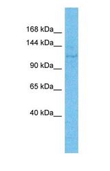 Western blot of PA24B Antibody with human Jurkat Whole Cell lysate.
