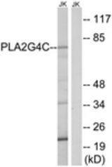 Western blot of extracts from Jurkat cells, using PLA2G4C Antibody. The lane on the right is treated with the synthesized peptide.