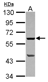 Sample (30 ug of whole cell lysate) A: 293T 10% SDS PAGE PLA2G4F / CPLA2-zeta antibody diluted at 1:1000