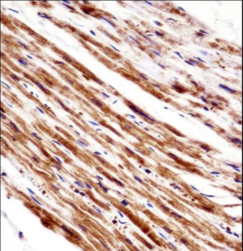 PLA2G5 Antibody immunohistochemistry of formalin-fixed and paraffin-embedded human heart tissue followed by peroxidase-conjugated secondary antibody and DAB staining.