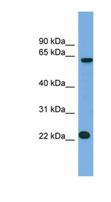 MIS18A / C21orf45 antibody LS-C111072 Western blot of NCI-H226 cell lysate.