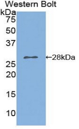 Western blot of recombinant PLA2G6 / IPLA2.