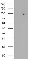 HEK293T cells were transfected with the pCMV6-ENTRY control (Left lane) or pCMV6-ENTRY PLA2G6 (Right lane) cDNA for 48 hrs and lysed. Equivalent amounts of cell lysates (5 ug per lane) were separated by SDS-PAGE and immunoblotted with anti-PLA2G6.
