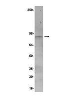 WB: RINB2 cell lysate was probed with anti-iPLA2 (1:500).