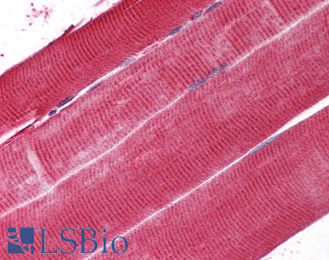 Anti-PLA2G6 antibody IHC of human skeletal muscle. Immunohistochemistry of formalin-fixed, paraffin-embedded tissue after heat-induced antigen retrieval. Antibody LS-B1603 dilution 1:200.