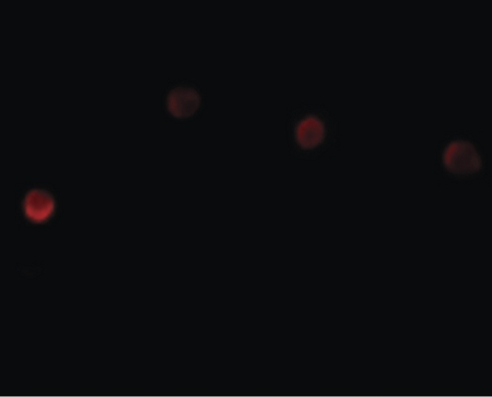 Immunofluorescence of PLAC1 in HeLa cells with PLAC1 antibody at 20 ug/ml.