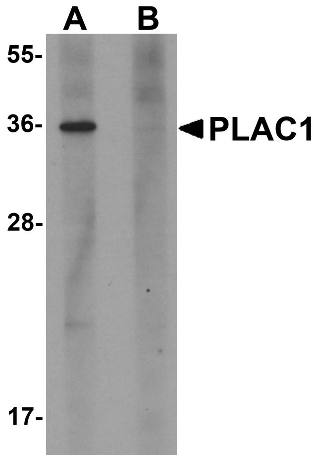 Western blot analysis of PLAC1 in human placenta tissue lysate with PLAC1 antibody at 1 ug/ml in (A) the absence and (B) the presence of blocking peptide.