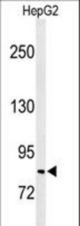 Western blot of C19orf21 Antibody in HepG2 cell line lysates (35 ug/lane). C19orf21 (arrow) was detected using the purified antibody.