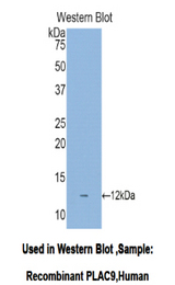 Western blot of recombinant PLAC9.
