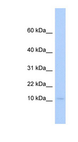 PLAC9 antibody LS-C102275 Western blot of Fetal Heart lysate.