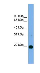 MITD1 antibody LS-C116503 Western blot of MCF7 cell lysate.