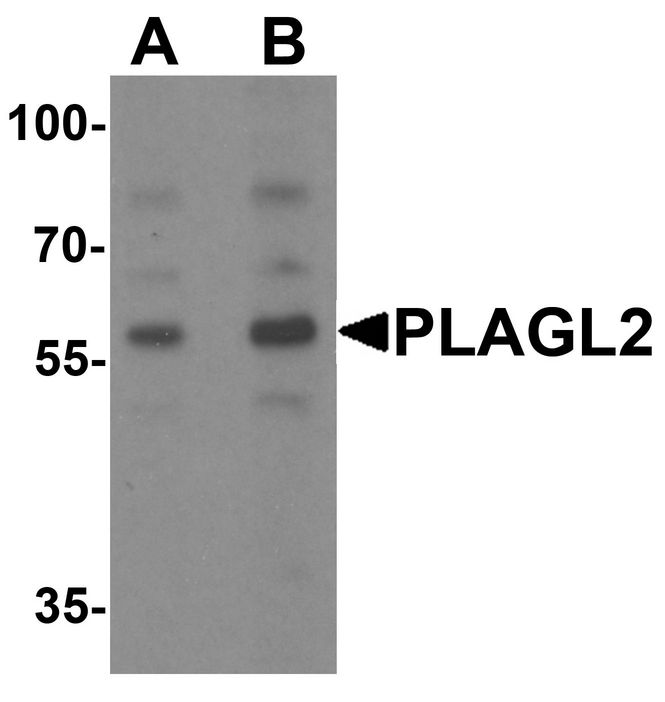 Western blot analysis of PLAGL2 in rat brain tissue lysate with PLAGL2 antibody at (A) 1 and (B) 2 ug/ml.