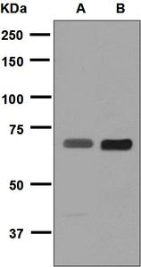 Western blot analysis on (A) HeLa and (B) human placenta lysates using anti-PLAP antibody.