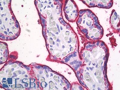 Anti-ALPP / PLAP / ALP antibody IHC of human placenta, trophoblast. Immunohistochemistry of formalin-fixed, paraffin-embedded tissue after heat-induced antigen retrieval. Antibody LS-B8629 dilution 1:50.