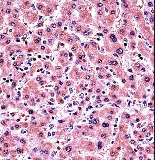 ALPP Antibody immunohistochemistry of formalin-fixed and paraffin-embedded human liver tissue followed by peroxidase-conjugated secondary antibody and DAB staining.