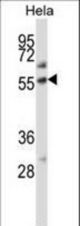 ALPP Antibody western blot of HeLa cell line lysates (35 ug/lane). The ALPP antibody detected the ALPP protein (arrow).