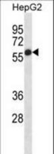 ALPP Antibody western blot of HepG2 cell line lysates (35 ug/lane). The ALPP antibody detected the ALPP protein (arrow).