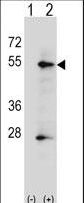 Western blot of ALPP (arrow) using rabbit polyclonal ALPP Antibody. 293 cell lysates (2 ug/lane) either nontransfected (Lane 1) or transiently transfected (Lane 2) with the ALPP gene.