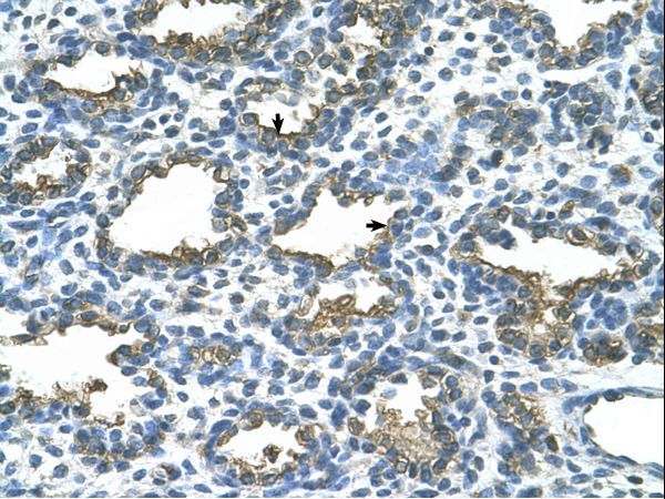 ALPP / Placental Alkaline Phosphatase antibody LS-C31958 was used in IHC to stain formalin-fixed, paraffin-embedded human lung.