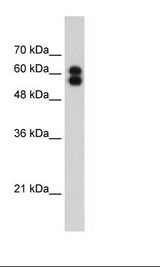 HepG2 Cell Lysate