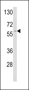 Western blot of TPA Antibody in A2058 cell line lysates (35 ug/lane). TPA (arrow) was detected using the purified antibody.