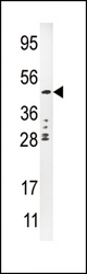 Western blot of anti-PLAU antibody in CEM cell line lysate (35 ug/lane). PLAU(arrow) was detected using the purified Pab