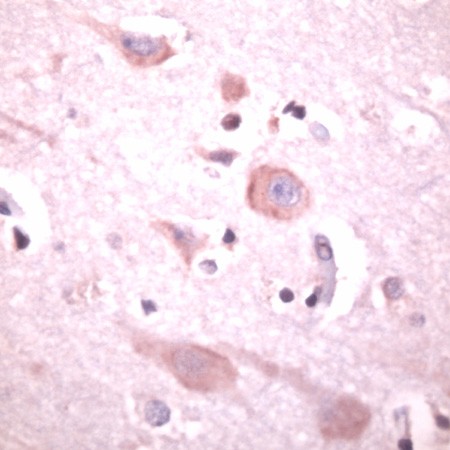 Human brain stained with Anti-PLC-beta1