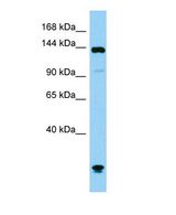 Western blot of Plcb1 Antibody - C-terminal region in Mouse Testis cells lysate.