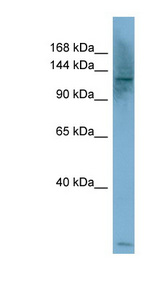 PLCB1 antibody LS-C107749 Western blot of HepG2 cell lysate.