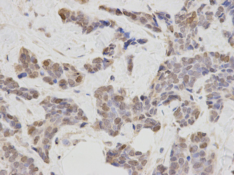 Immunohistochemistry of paraffin-embedded rat lung using PLCB1 antibody at dilution of 1:200 (400x lens).