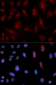 Immunofluorescence analysis of U2OS cell using PLCB1 antibody. Blue: DAPI for nuclear staining.