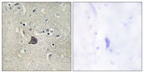 IHC of paraffin-embedded human brain, using PLC beta3 (Phospho-Ser537) Antibody. The sample on the right was incubated with synthetic peptide.