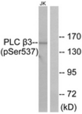 Western blot of extracts from Jurkat cells treated with UV 15', using PLC beta3 (Phospho-Ser537) Antibody. The lane on the right was incubated with synthetic peptide.