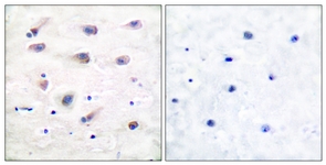 IHC of paraffin-embedded human brain, using PLCB3 (Phospho-Ser1105) Antibody. The sample on the right was incubated with synthetic peptide.