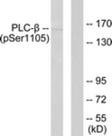 Western blot of extracts from A431 cells, using PLCB3 (Phospho-Ser1105) Antibody. The lane on the right was incubated with synthetic peptide.