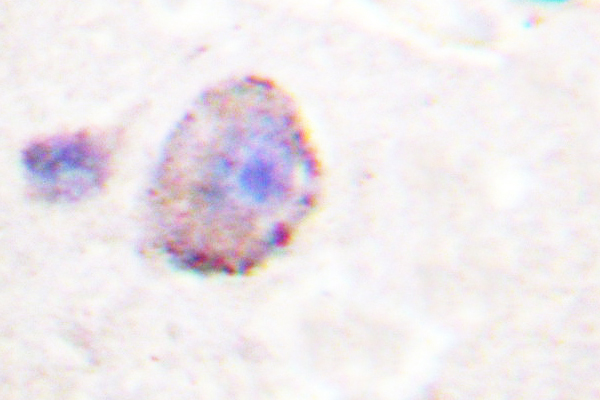 IHC of PLC 3 (D1099) pAb in paraffin-embedded human brain tissue.