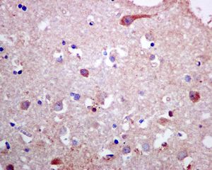 IHC of paraffin-embedded human brain tissue using anti-PLCD1 antibody.