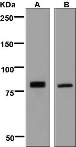 Western blot analysis on (A) HeLa and (B) fetal lung lysates using anti-PLCD1 antibody.