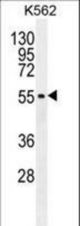 MITF Antibody western blot of K562 cell line lysates (35 ug/lane). The MITF antibody detected the MITF protein (arrow).
