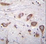 PLCL2 Antibody immunohistochemistry of formalin-fixed and paraffin-embedded human brain tissue followed by peroxidase-conjugated secondary antibody and DAB staining.