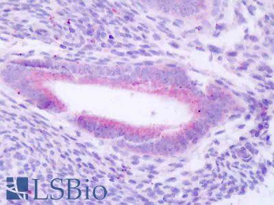 Human, Uterus: Formalin-Fixed Paraffin-Embedded (FFPE)