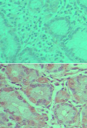 IHC of PLD2 in formalin-fixed, paraffin-embedded human stomach tissue using preimmune sera (top) and LS-C148557 (bottom) at 1:50.