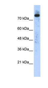 PLD2 antibody LS-C101680 Western blot of Transfected 293T cell lysate.