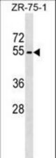 PLD4 Antibody western blot of ZR-75-1 cell line lysates (35 ug/lane). The PLD4 antibody detected the PLD4 protein (arrow).