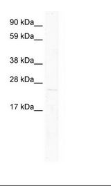 Fetal Heart Lysate