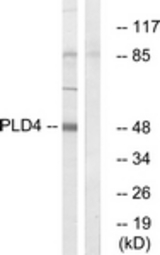 Western blot of extracts from Jurkat cells, using PLD4 Antibody. The lane on the right is treated with the synthesized peptide.