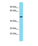 Western blot of PLD5 Antibody - C-terminal region with human Fetal heart cells lysate.